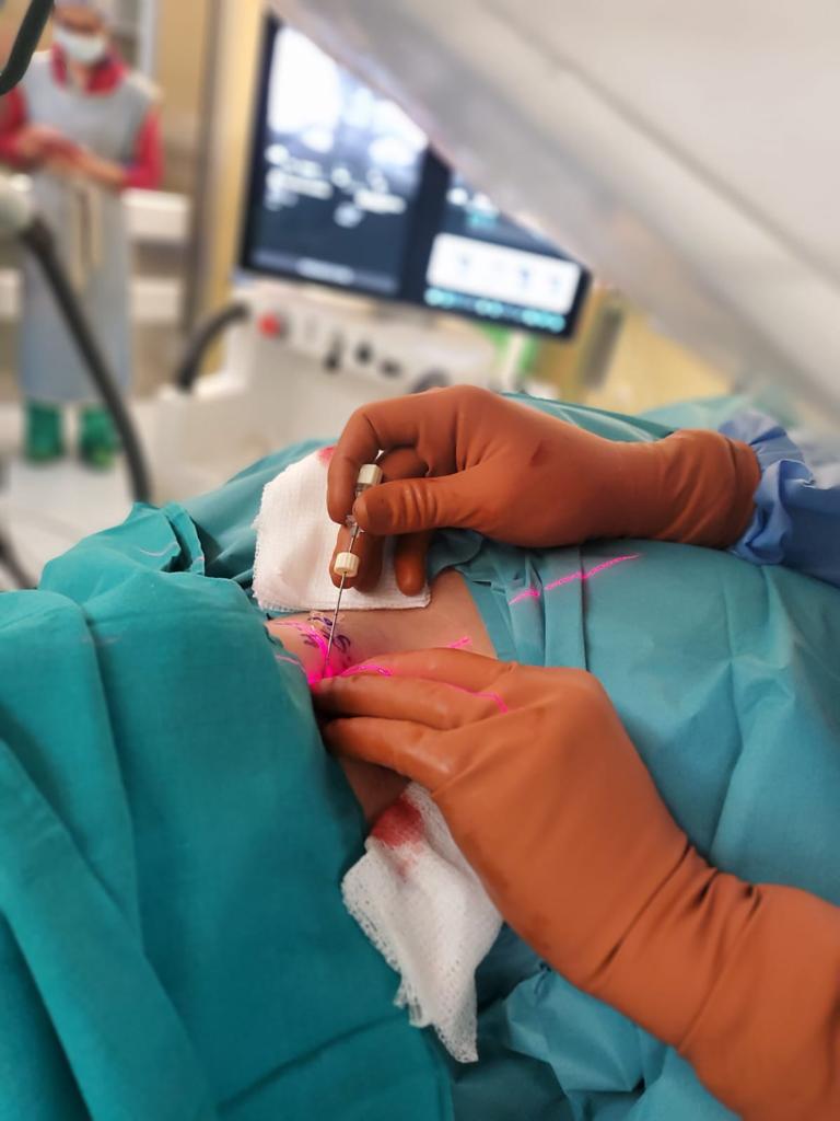 El Hospital Universitario de La Palma incorpora una técnica pionera en Canarias en el tratamiento de hernias cervicales